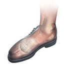 Hapad Metatarsal Bars